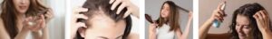 Hair Fall: Often triggered by stress, iron deficiency, or harsh products.