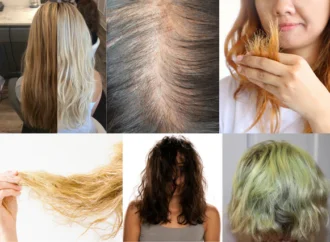 Hard Water Hair Loss in Pakistan: Causes, Signs & How to Actually Fix It