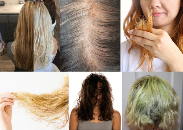 Hard Water Hair Loss in Pakistan: Causes, Signs & How to Actually Fix It