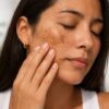 How to Get Rid of Hyperpigmentation Naturally in 2026: A Guide for Every Skin Tone