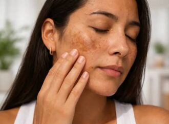 How to Get Rid of Hyperpigmentation Naturally in 2026: A Guide for Every Skin Tone