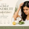 10 Best Dandruff Treatment Methods 2026-27: Complete Scalp Care Guide