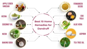 Home Remedies for Dandruff Relief